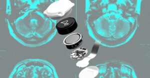 Did Neuralink make the wrong bet?